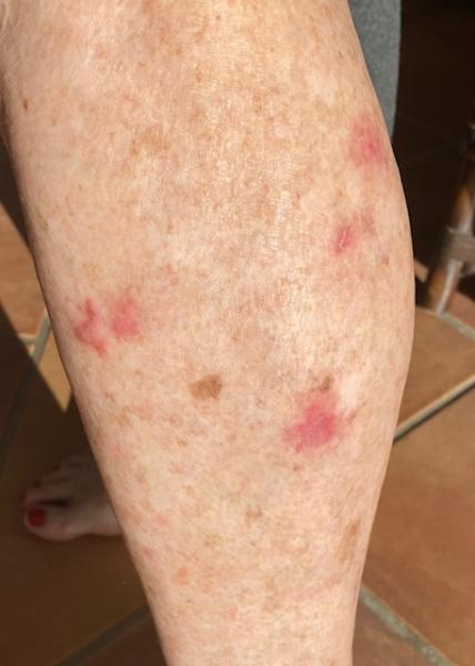 left_lower_leg.jpg