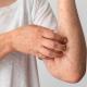 How_Long_Does_it_Take_to_Treat_Autoimmunity1.jpg